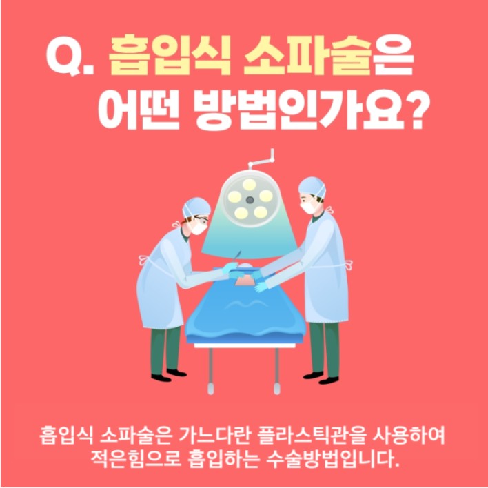 소파술 안내카드